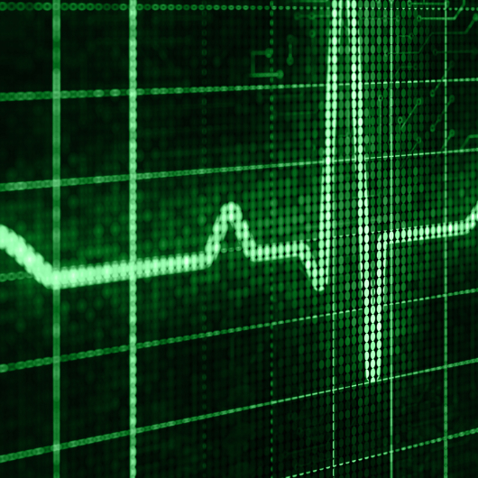 Green ECG-style graph visualizing cloud performance metrics, highlighting smarter hybrid IT strategies for optimized colocation workloads.
